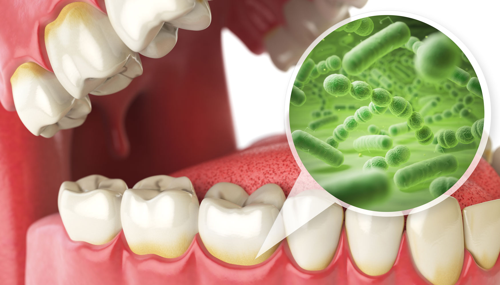 oraldiseasegraphic The Facial & Oral Surgery Center