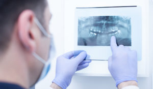 Why Choose an Oral Surgeon?